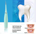 Détartreur Dentaire Professionnel - DentalCare™
