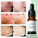 Sérum de Perfection Instantanée Zéro Pore