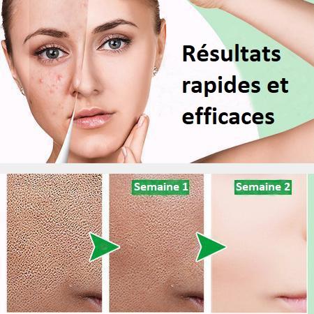 Sérum de Perfection Instantanée Zéro Pore