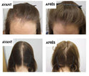 Sérum Naturel contre la perte de Cheveux