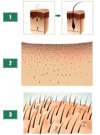 Sérum Naturel contre la perte de Cheveux