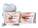 Kit de Blanchiment Dentaire Avec Nano Technologie