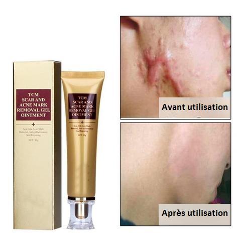 Sérum Anti-Cicatrices - Cicatrices d'acné et Vergetures