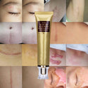 Sérum Anti-Cicatrices - Cicatrices d'acné et Vergetures