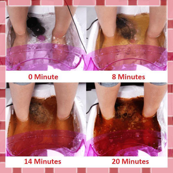 Générateur Ionique Pour Bain De Pieds