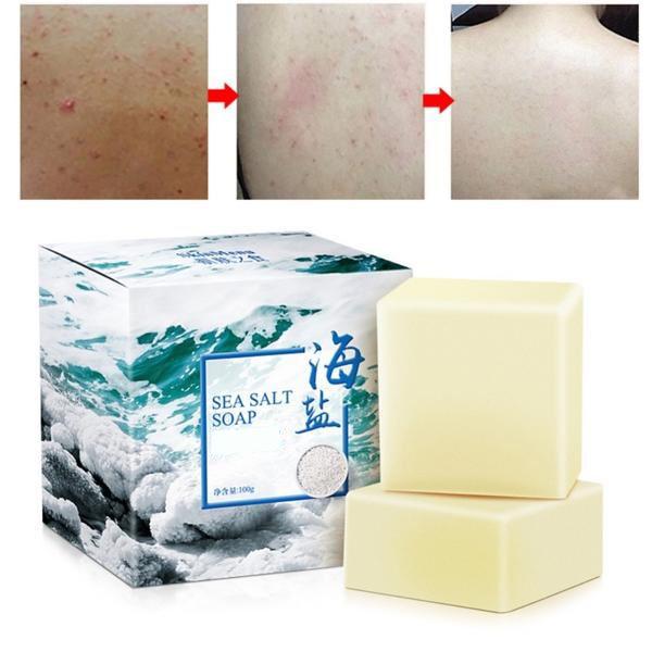 Savon Sel de Mer - Traitement Acné