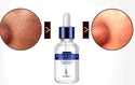 Complexe Anti-âge - Acide Hyaluronic - Vitamine B5 - Lift - Repulpant