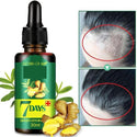 Sérum Naturel contre la perte de Cheveux